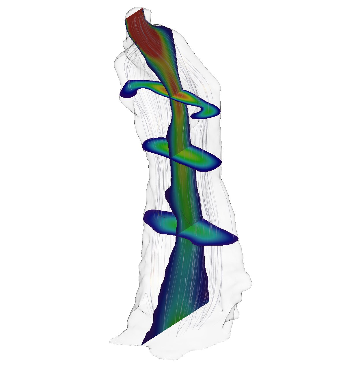 Example of pharyngeal airflow simulation